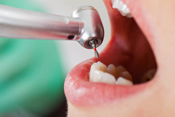 Best Mobile Emergency Dentist in Baytown, TX